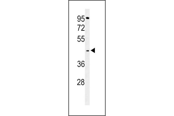 TECR Antikörper  (C-Term)