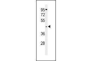 TECR anticorps  (C-Term)