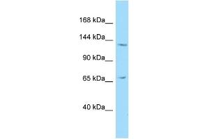 Host: Rabbit Target Name: NEMF Sample Type: HepG2 Whole Cell lysates Antibody Dilution: 1. (NEMF Antikörper  (C-Term))