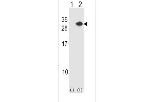 Western blot analysis of RCAN1 (arrow) using rabbit polyclonal RCAN1 Antibody (N-term) (ABIN1539360 and ABIN2848483). (RCAN1 Antikörper  (N-Term))