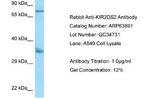 Western Blotting (WB) image for anti-Killer Cell Immunoglobulin-Like Receptor 2DS2 (KIR2DS2) (N-Term) antibody (ABIN2789655) (KIR2DS2 Antikörper  (N-Term))