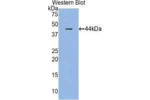 Western blot analysis of the recombinant protein. (Cathelicidin Antikörper  (AA 30-175))