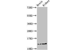 Western Blot Positive WB detected in: Mouse brain tissue, Mouse kidney tissue All lanes: PVALB antibody at 3 μg/mL Secondary Goat polyclonal to rabbit IgG at 1/50000 dilution Predicted band size: 13 kDa Observed band size: 13 kDa (PVALB Antikörper  (AA 2-110))