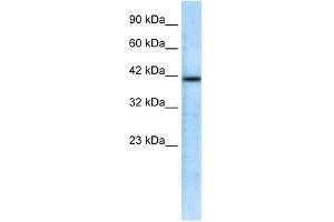 Western Blotting (WB) image for anti-CHRNA7 (Cholinergic Receptor, Nicotinic, alpha 7, Exons 5-10) and FAM7A (Family with Sequence Similarity 7A, Exons A-E) Fusion (CHRFAM7A) (N-Term) antibody (ABIN633716)