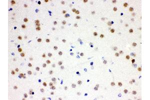Anti- Cdc25B Picoband antibody, IHC(P) IHC(P): Mouse Brain Tissue (CDC25B Antikörper  (AA 119-248))