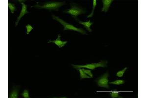 Immunofluorescence of monoclonal antibody to ARMET on HeLa cell. (MANF Antikörper  (AA 116-185))