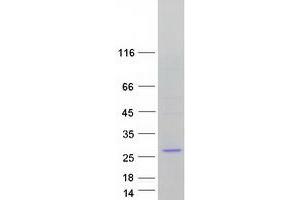 Validation with Western Blot (DCTN3 Protein (Transcript Variant 1) (Myc-DYKDDDDK Tag))