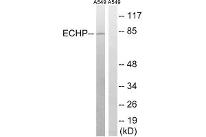 Western blot analysis of extracts from A549 cells, using EHHADH antibody. (EHHADH Antikörper  (Internal Region))