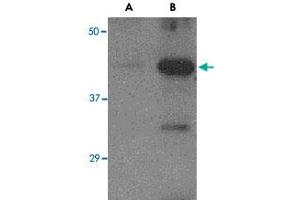 Western blot analysis of (A) 5 ng and (B) 25 ng of recombinant Hemagglutinin with Avian Influenza Hemagglutinin polyclonal antibody  at 1 ug/mL . (Hemagglutinin Antikörper  (N-Term))