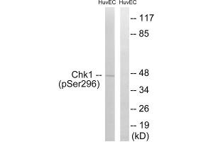 Western blot analysis of extracts from HUVEC cells, treated with UV (15mins), using CHK1 (Phospho-Ser296) antibody. (CHEK1 Antikörper  (pSer296))