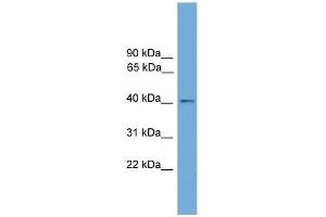 Human HeLa; WB Suggested Anti-ZDHHC18 Antibody Titration: 0. (ZDHHC18 Antikörper  (Middle Region))