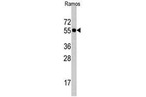 Western blot analysis of CDC6 polyclonal antibody  in Ramos cell lysate (35 ug/lane). (CDC6 Antikörper  (N-Term))