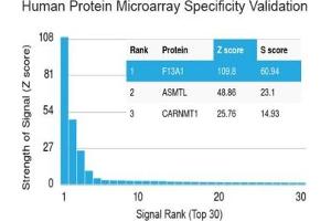 Analysis of HuProt(TM) microarray containing more than 19,000 full-length human proteins using Factor XIIIa antibody (clone F13A1/1683). (F13A1 Antikörper  (AA 46-181))
