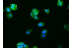 Immunofluorescence (IF) image for anti-c-Fos (c-Fos) antibody (ABIN7127496)