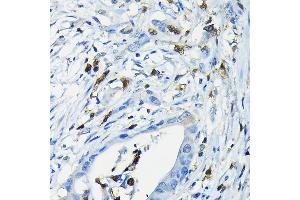 Immunohistochemistry (IHC) image for anti-Nuclear Factor of Activated T-Cells, Cytoplasmic, Calcineurin-Dependent 3 (NFATC3) (AA 1-290) antibody (ABIN6144558)