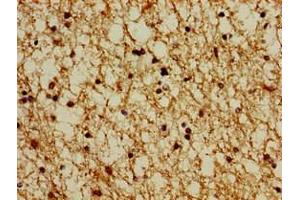 Immunohistochemistry of paraffin-embedded human brain tissue using ABIN7164927 at dilution of 1:100 (PSMG1 Antikörper  (AA 91-200))
