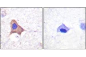 Immunohistochemistry analysis of paraffin-embedded human brain, using CD71/TfR (Phospho-Ser24) Antibody. (Transferrin Receptor Antikörper  (pSer24))