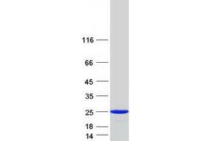Western Blotting (WB) image for Hippocalcin-Like 1 (HPCAL1) (Transcript Variant 2) protein (Myc-DYKDDDDK Tag) (ABIN2722767)
