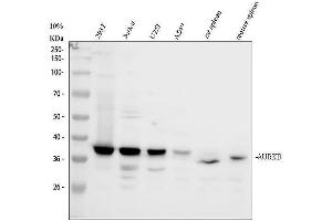 Western blot analysis of AURKB using anti-AURKB antibody (ABIN3043048).