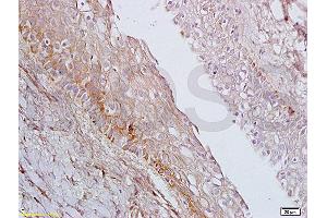 Formalin-fixed and paraffin embedded rat ovary tissue labeled with Anti-AGPAT4 Polyclonal Antibody, Unconjugated (ABIN708671) at 1:200 followed by conjugation to the secondary antibody, (SP-0023), and DAB staining (AGPAT4 Antikörper  (AA 231-330))