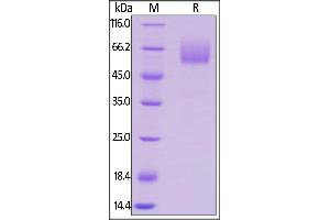 SDS-PAGE (SDS) image for CD47 (CD47) (AA 19-140) (Active) protein (Fc Tag) (ABIN5954914)