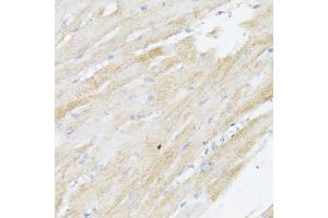 Immunohistochemistry (IHC) image for anti-Bone Morphogenetic Protein Receptor, Type II (serine/threonine Kinase) (BMPR2) (AA 27-150) antibody (ABIN7265906)
