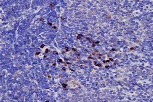 Immunohistochemistry analysis of paraffin-embedded rat spleen using,PRELID1 (ABIN7075173) at dilution of 1: 4000 (PRELID1 Antikörper)