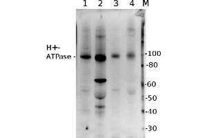 5 µg of total protein from (1) Zea mays lwhole cell, extracted with Protein Extration Buffer, PEB, (2) Hordeum vulgare leaf extracted with PEB, (3) Spinacia oleracea total cell extracted with PEB, (4) Arabidopsis thaliana  were separated on  4-12% NuPage (Invitrogen) LDS-PAGE and blotted 1h to PVDF. (ATP6AP1 Antikörper)