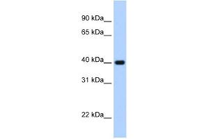 WB Suggested Anti-ZNF187 Antibody Titration:  2. (ZNF187 Antikörper  (C-Term))