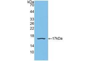 Detection of Recombinant SNRPD1, Human using Polyclonal Antibody to Small Nuclear Ribonucleoprotein Polypeptide D1 (SNRPD1) (SNRPD1 Antikörper  (AA 1-119))