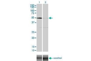 Western Blotting (WB) image for anti-serum/glucocorticoid Regulated Kinase 1 (SGK1) (AA 1-432) antibody (ABIN598922) (SGK1 Antikörper  (AA 1-432))