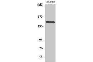 Western Blotting (WB) image for anti-RAD50 Homolog (S. Cerevisiae) (RAD50) (Internal Region) antibody (ABIN3186656) (RAD50 Antikörper  (Internal Region))