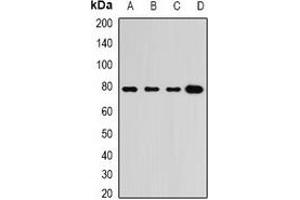 Western blot analysis of GRP3 expression in BT474 (A), A549 (B), mouse heart (C), mouse lung (D) whole cell lysates. (RASGRP3 Antikörper)