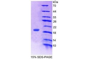SDS-PAGE (SDS) image for Gastric Inhibitory Polypeptide (GIP) (AA 22-153) protein (His tag) (ABIN2124924) (GIP Protein (AA 22-153) (His tag))