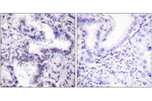 Immunohistochemistry (IHC) image for anti-X-Ray Repair Complementing Defective Repair in Chinese Hamster Cells 5 (Double-Strand-Break Rejoining) (XRCC5) (AA 683-732), (pThr714) antibody (ABIN1531294)