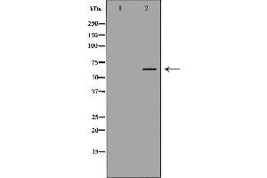 Western blot analysis of Jurkat  lysate using STIP1 antibody. (STIP1 Antikörper  (N-Term))