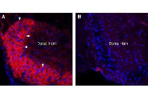 Expression of Synaptotagmin-1 in rat spinal cord.