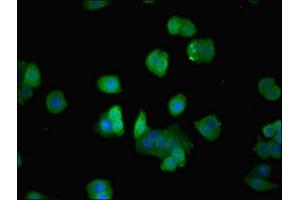 Immunofluorescent analysis of PC-3 cells using ABIN7143089 at dilution of 1:100 and Alexa Fluor 488-congugated AffiniPure Goat Anti-Rabbit IgG(H+L) (ARPC3 Antikörper  (AA 2-175))