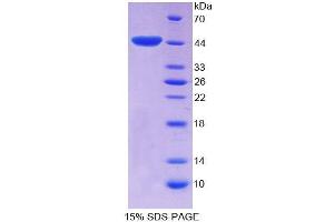 SDS-PAGE analysis of Rat EP300 Protein. (p300 Protein)