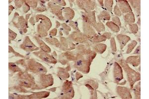 Immunohistochemistry of paraffin-embedded human heart tissue using ABIN7170088 at dilution of 1:100 (SLC12A7 Antikörper  (AA 11-117))