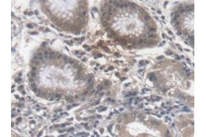 Immunohistochemistry (IHC) image for anti-Erythropoietin (EPO) (AA 28-193) antibody (ABIN7425611)