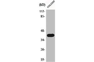 Western Blot analysis of COLO205 cells using Actin α3 Polyclonal Antibody (ACTG2 Antikörper  (N-Term))