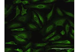 Immunofluorescence of purified MaxPab antibody to NARS on HeLa cell. (NARS Antikörper  (AA 1-548))