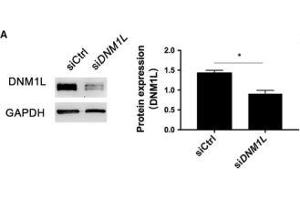 DNM1L deficiency alters mitochondria morphology and mitochondrial membrane potential in FLSs. (GAPDH Antikörper)
