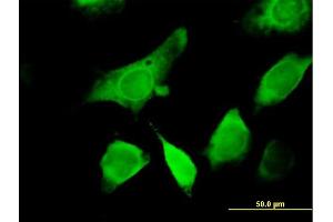 Immunofluorescence of purified MaxPab antibody to GEMIN6 on HeLa cell.