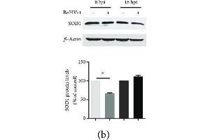 The effects of BoHV-1 infection on the gene expression of antioxidant enzymes. (SOD1 Antikörper  (AA 1-154))