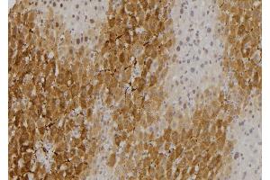 ABIN6275320 at 1/100 staining Rat liver tissue by IHC-P. (NCOA4 Antikörper  (C-Term))