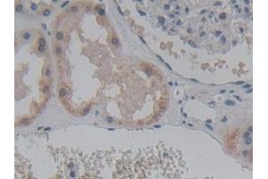 Detection of ABCC8 in Human Kidney Tissue using Polyclonal Antibody to ATP Binding Cassette Transporter C8 (ABCC8) (ABCC8 Antikörper  (AA 679-929))