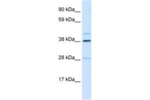 Western Blotting (WB) image for anti-Ceramide Synthase 3 (CERS3) antibody (ABIN2460261) (LASS3 Antikörper)
