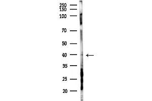 anti-G Protein-Coupled Receptor 22 (GPR22) (N-Term) antibody